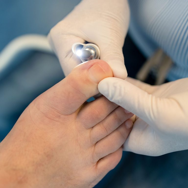 A closeup of podiatrist hands doing a hardware pedicure holding a toe of a patient